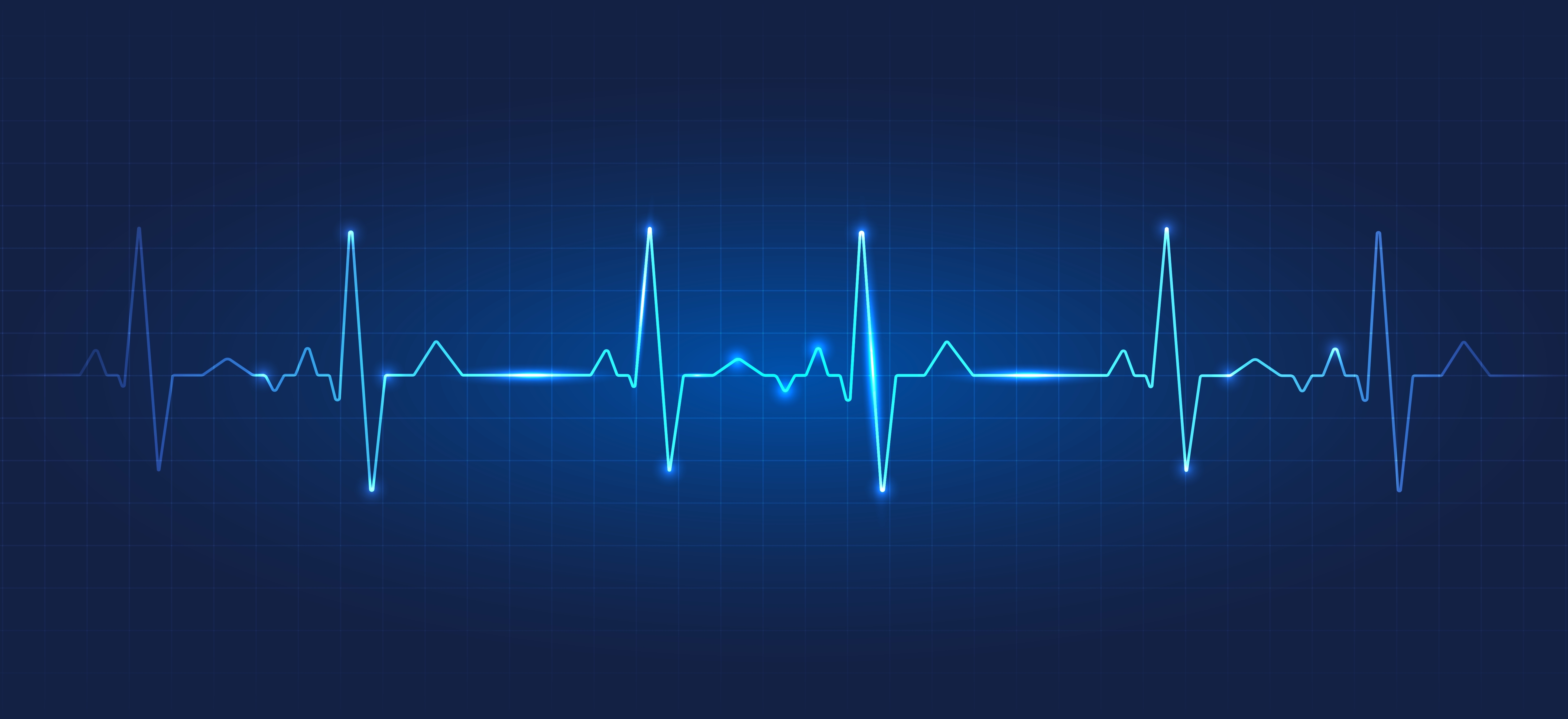 Decorative image of a pulse readout.